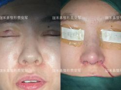 -JustHer宁波珈禾医疗美容医院