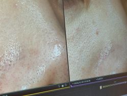 -苑苑vbeauty科技美容SPA