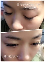 睫毛嫁接-光SPA科技美肤