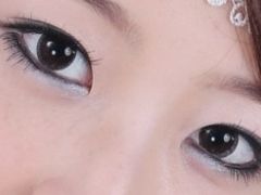 小老虎要求做的浅了-上海华安整形外科门诊部