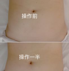 -Lily纤美·科技减脂中心