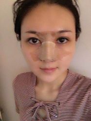 -洁铭新加坡医美