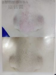 点击看大图 -蕾特恩专业祛痘·皮肤管理