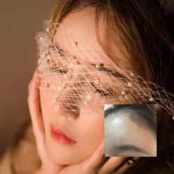 点击看大图 -大麦微针植发丨全国连锁