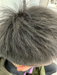 -熙朵美学植发·连锁品牌