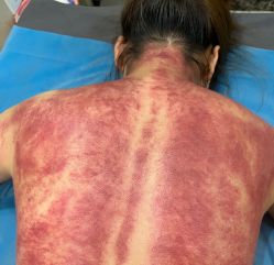 -摩瘦纤体订制减肥