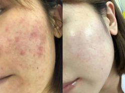 -美愈美肤MEIYU SKIN