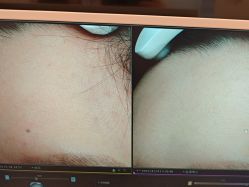 -苑苑vbeauty科技美容SPA
