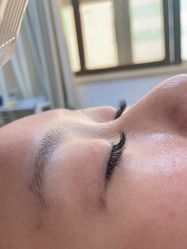 -铂特丽医美·眼鼻整形·光电美肤·注射抗衰