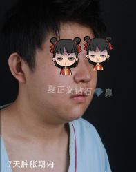 -北京米扬丽格医疗美容·联合丽格鼻整形中心