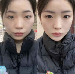 -素美医疗美容·西南眼鼻整形·修复基地