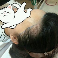 点击看大图 -Yue Show馨选·半永久纹眉纹眼线