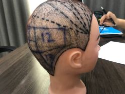 点击看大图 -雍禾植发全国连锁