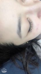 点击看大图 -郡艺医疗美容·微整·眼鼻吸脂
