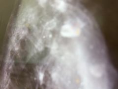 -张钰强中医正骨推拿连锁(华发商都店)