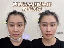 -Yestar艺星医疗美容医院