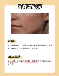 -苗方清颜痘肌研究所