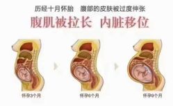 -莫纳瑜伽·普拉提