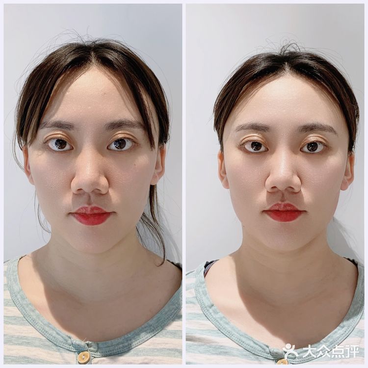 深圳有家日式小颜整骨,体验日式服务不必去日本,来这里就行