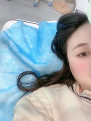 -新雨池不针清祛痘