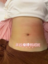 -Lily纤美·科技减脂中心