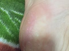 -郑远元专业修脚房(栖山路店)