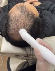 -菩叶脱发白发中心