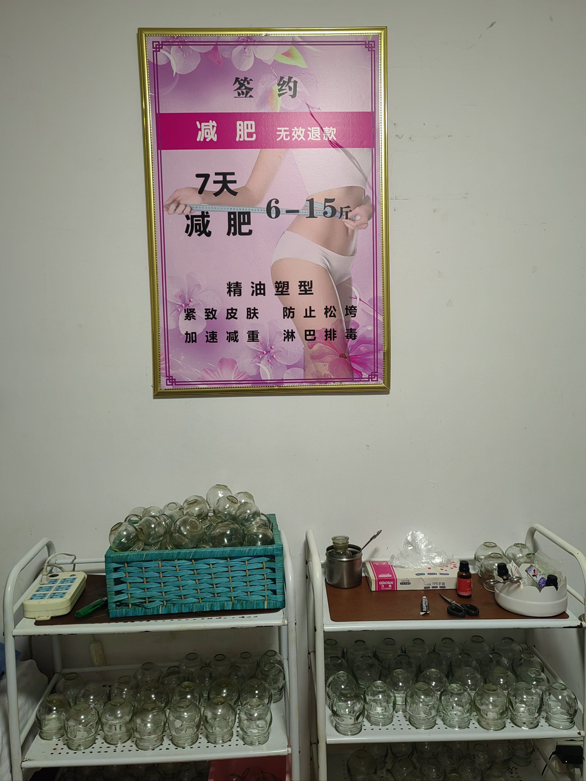 拔罐疗法减肥去施,中医也能时尚!