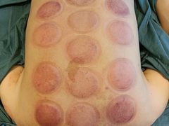 -阮氏中医推拿·颈肩腰腿(世纪公园店)