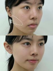 -Yestar重庆艺星医疗美容医院