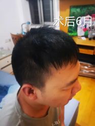 -雍禾植发全国连锁