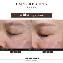 -丽美妍医疗美容·皮秒·立体分层抗衰