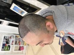 点击看大图 -大麦微针植发丨全国连锁