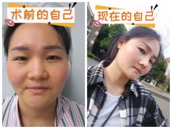 -素美医疗美容·西南眼鼻整形·修复基地
