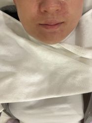 -海涛医疗美容·面部抗衰·注射美鼻