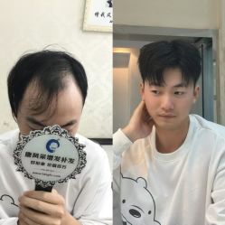 -唐风采假发补发定制