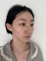 -四川米兰柏羽医学美容医院