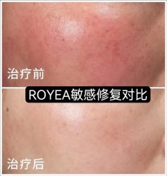 -ROYEA茹彦祛痘·问题肌肤修护中心