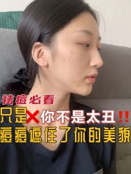 -Yestar宁波艺星整形医院