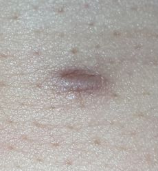 -西安现代妇产医院医疗美容