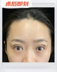 -素美医疗美容·西南眼鼻整形·修复基地