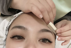 -苗方清颜专业祛痘连锁机构