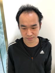 -发饰美男士增发补发假发定制店