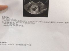 -伊丽莎白妇科医院·早孕检查