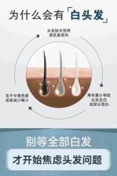 点击看大图 -舒欣头疗·俏丝谧语 白发脱发专业护理