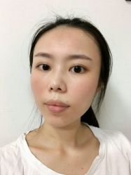 -广东韩妃整形外科医院