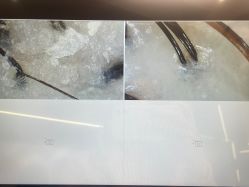 点击看大图 -KIMI BEAUTY科技美肌抗衰中心