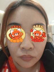 点击看大图 体验前-深圳米兰柏羽医疗美容医院