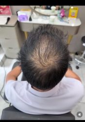 -唐风采假发补发定制