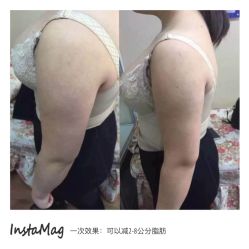 光SPA热力塑-光SPA科技美肤